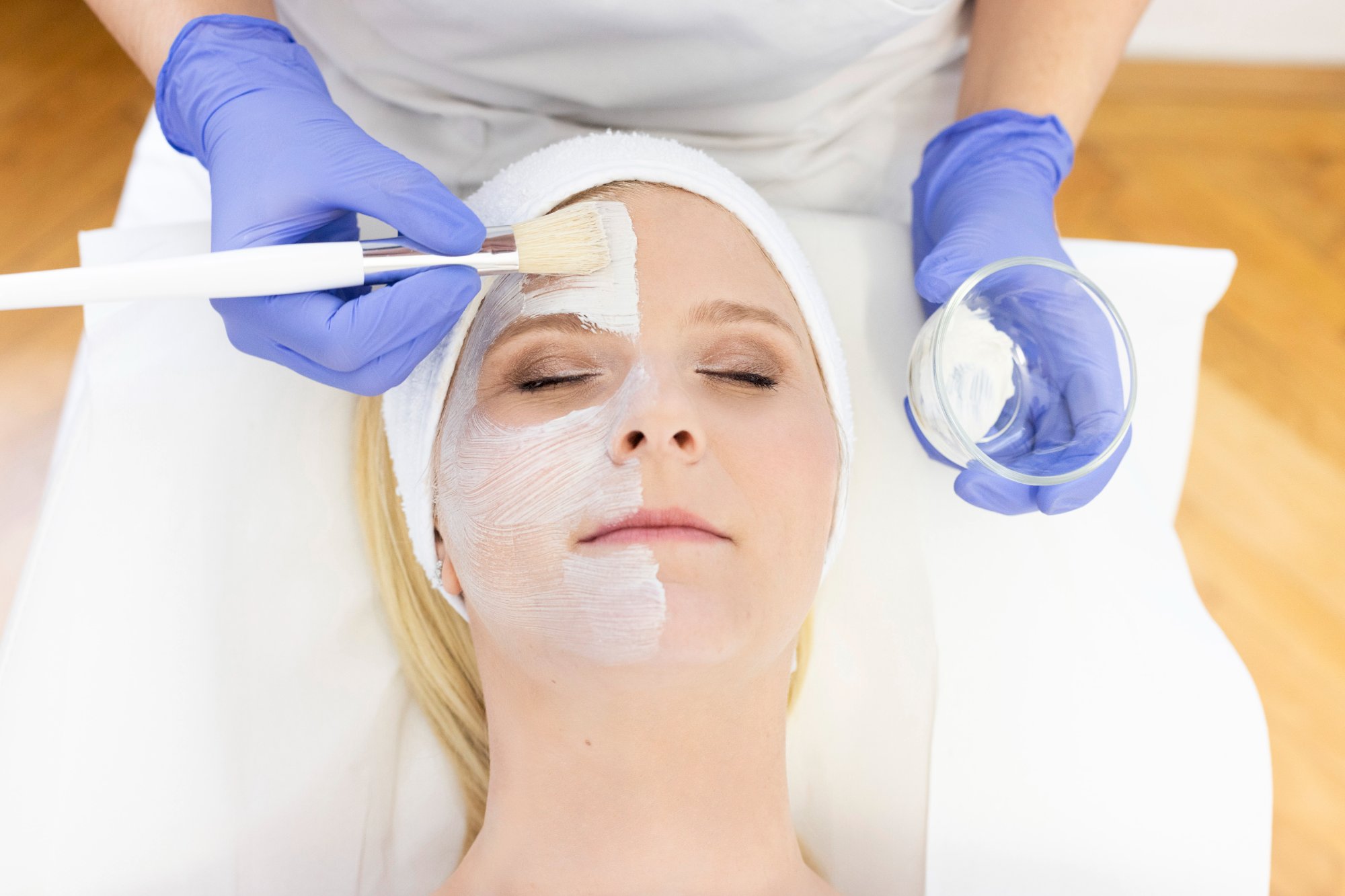 Chemisches Peeling – Gesichtsbehandlung